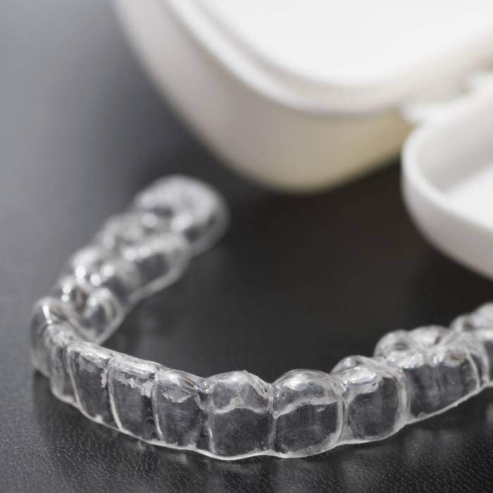 invisalign-2