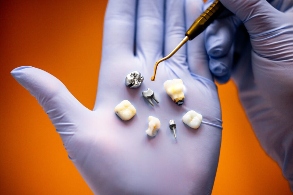 Dental crown and filling options for restoring a damaged tooth in McKinney, TX